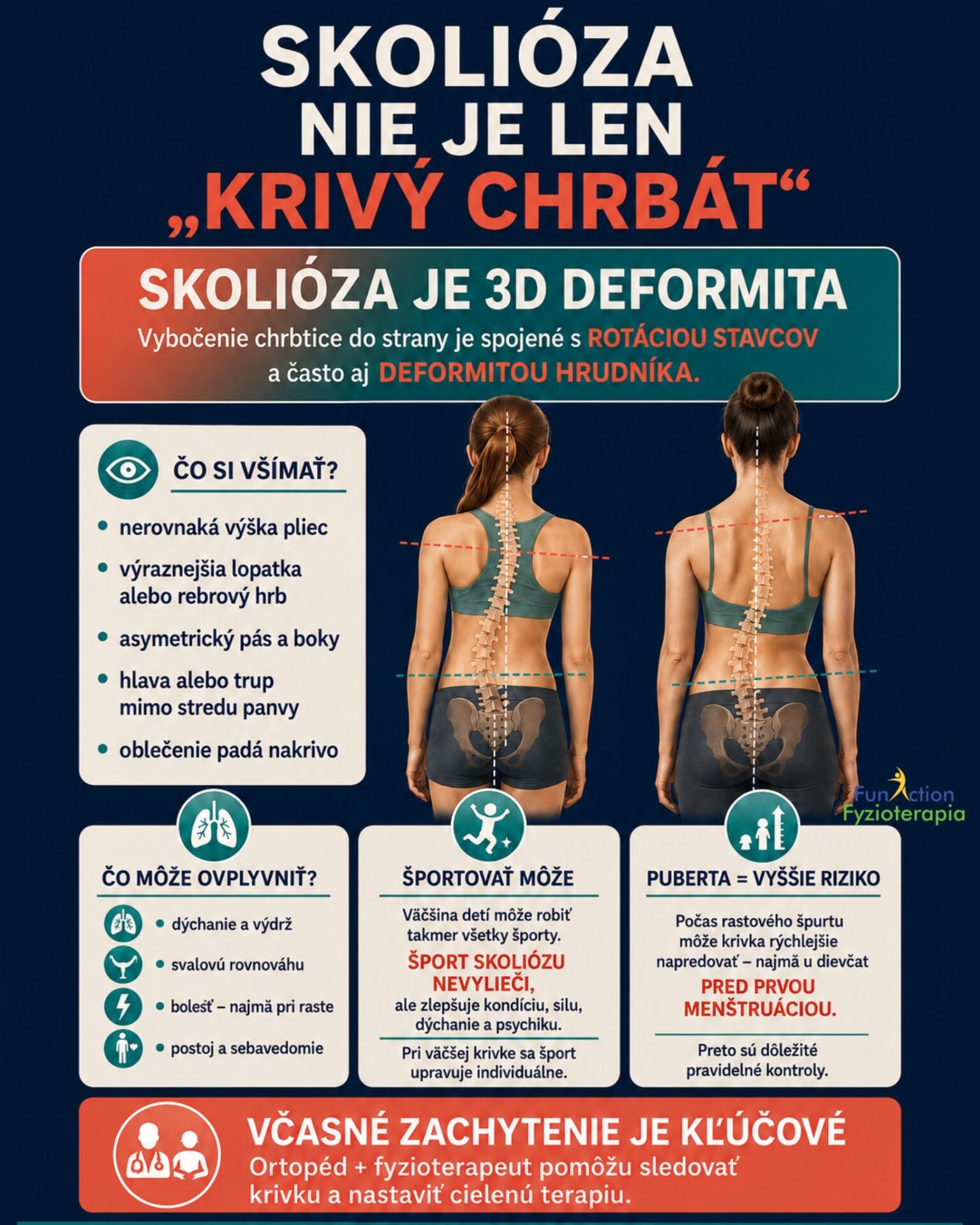 🌀 Skolióza nie je len „krivý chrbát“. Je to trojrozmerná deformita chrbtice spojená s rotáciou stavcov a často aj so zmenou tvaru hrudníka.

Všimli ste si u vás, vašich blízkych či dieťaťa:

🔹 jedno rameno alebo lopatku vyššie,
🔹 nerovnaké „trojuholníky“ v páse,
🔹 vybočenie trupu či naklonenú panvu,
🔹 výraznejšiu asymetriu chrbta pri predklone?

Práve obdobie rýchleho rastu a puberty je čas, keď sa môže krivka zhoršovať najrýchlejšie. Preto je dôležité nič neodkladať a spojiť vyšetrenie u ortopéda s individuálne nastavenou fyzioterapiou.

O ďalšom postupe nerozhoduje iba Cobbov uhol, ale aj vek, zostávajúci rast, typ a progresia krivky či rotácia stavcov. Ani korzet, ani zákaz športu preto nie sú automatickým riešením pre každého.

💙 Väčšina detí/ľudí so skoliózou môže naďalej športovať. Pohyb zlepšuje kondíciu, silu, dýchanie aj psychiku – šport však samotnú skoliózu nevylieči a tréning je vhodné prispôsobiť konkrétnej krivke.

V našej ambulancii sa venujeme aj metóde L. Schrothovej – špecifickému 3D cvičeniu podľa typu skoliózy a potrieb konkrétneho človeka.

📩 Objednajte svoje dieťa alebo seba na odborné fyzioterapeutické vyšetrenie.
🌐 fyzioterapiafunaction.sk

#skolioza #schroth #schrothmetoda #fyzioterapia #detskafyzioterapia #chrbtica #zdravachrbtica #drzanietela #zilina #funactionfyzioterapia
