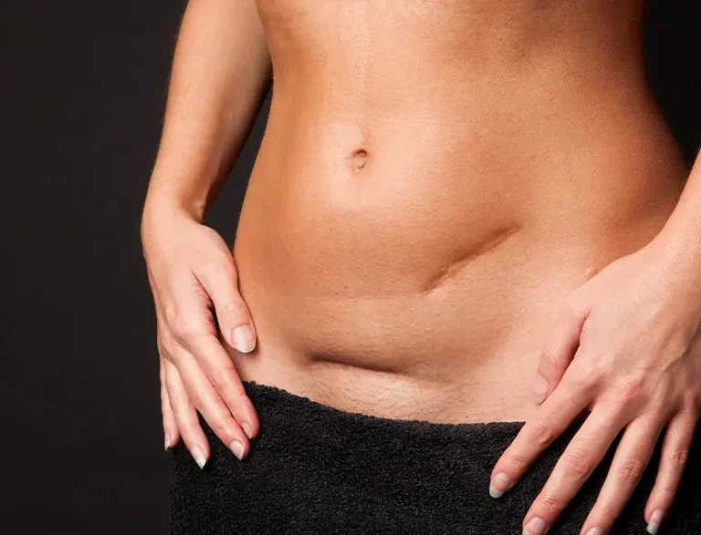 Jazvy: Pamäť tela, ktorú nevidíme na prvý pohľad