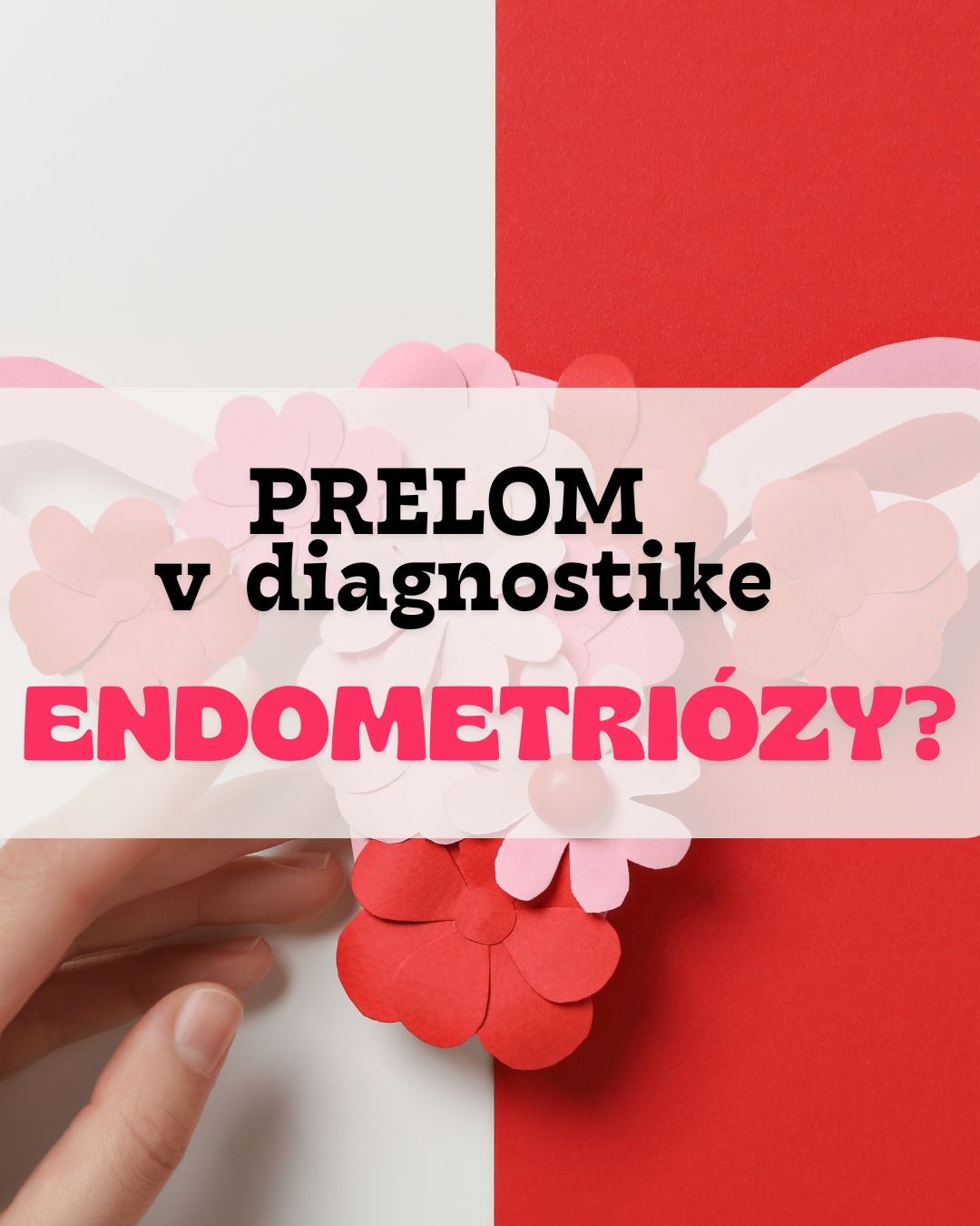 🩺 Endometrióza patrí medzi najčastejšie gynekologické ochorenia, no napriek tomu býva roky prehliadaná.
📌 Podľa najnovších štúdií postihuje približne 1 z 10 žien v reprodukčnom veku — celosvetovo ide o viac než 190 miliónov žien.
❗ Problémom je, že diagnostika často trvá extrémne dlho:
• priemerne 7–9 rokov
• niektoré štúdie uvádzajú až 10–12 rokov do správnej diagnózy
Prečo?
➡️ symptómy sa často zľahčujú ako „normálna menštruačná bolesť“
➡️ ochorenie sa zamieňa za IBS, psychické problémy či urologické ťažkosti
➡️ bežné USG a MRI často nevidia superficiálnu formu endometriózy
Mnohé ženy preto absolvujú roky bolesti, únavy, neplodnosti či opakovaných vyšetrení bez jasnej odpovede.
🧬 Nová štúdia DETECT z Oxfordu preto vzbudila veľký záujem — vedcom sa podarilo zobraziť aj „neviditeľné“ ložiská endometriózy pomocou špeciálneho SPECT-CT vyšetrenia.
Ak sa výsledky potvrdia vo väčších štúdiách, môže ísť o významný krok k skoršej a menej invazívnej diagnostike.
Celá štúdia: https://www.thelancet.com/journals/lanogw/article/PIIS3050-5038(26)00048-8/fulltext
#endometriosis #gynecology #gynecologyphysiotherapy #discovery